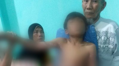 Disengat Listrik, Anak Umur 8 tahun Asal Lombok Terpental 1 Meter dan Dilarikan Ke Rumah Sakit